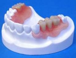 A model of the upper and lower teeth